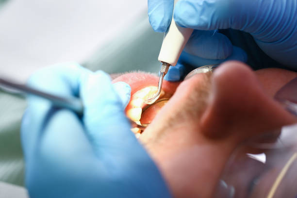Best Emergency Root Canal Treatment in Elk Rapids, MI