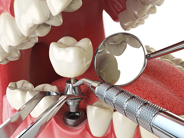 Best Emergency Dental Services for Seniors in Elk Rapids, MI